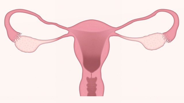 Endometrioosi esiintyy kohdun ulkopuolella. Adenymyoosi kohdussa.
